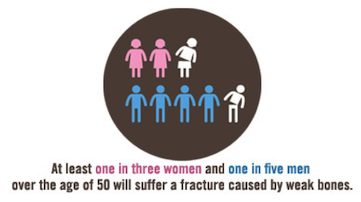 Osteoporosis-Bone-Scan-Promotion-Stats